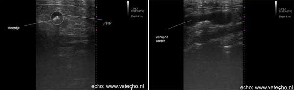 Op de echo is een steen in de ureter te zien